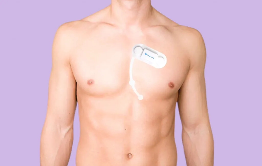 Holter Monitoring